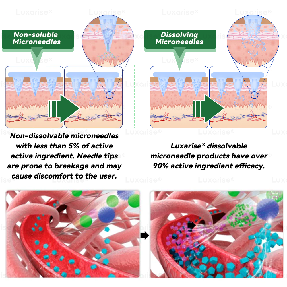 𝐎𝐟𝐟𝐢𝐜𝐢𝐚𝐥 𝐒𝐭𝐨𝐫𝐞 |🌺𝑳𝒖𝒙𝒂𝒓𝒊𝒔e® Moringa & Berberine 10-in-1 Nano Microneedle Patch 📢 (Just once a Day, Visible changes s in 7 Days) ✅ 𝐅𝐨𝐫 𝐨𝐛𝐞𝐬𝐢𝐭𝐲, 🅛🅞🅞🅢🅔 🅢🅚🅘🅝,𝐝𝐢𝐚𝐛𝐞𝐭𝐞𝐬, 𝐬𝐥𝐞𝐞𝐩 𝐚𝐩𝐧𝐞𝐚, 𝐣𝐨𝐢𝐧𝐭 𝐢𝐬𝐬𝐮𝐞𝐬, 𝐚𝐧𝐝 𝐦𝐨𝐫𝐞