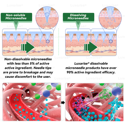 𝐎𝐟𝐟𝐢𝐜𝐢𝐚𝐥 𝐒𝐭𝐨𝐫𝐞 |🌺𝑳𝒖𝒙𝒂𝒓𝒊𝒔e® Moringa & Berberine 10-in-1 Nano Microneedle Patch 📢 (Just once a Day, Visible changes s in 7 Days) ✅ 𝐅𝐨𝐫 𝐨𝐛𝐞𝐬𝐢𝐭𝐲, 🅛🅞🅞🅢🅔 🅢🅚🅘🅝,𝐝𝐢𝐚𝐛𝐞𝐭𝐞𝐬, 𝐬𝐥𝐞𝐞𝐩 𝐚𝐩𝐧𝐞𝐚, 𝐣𝐨𝐢𝐧𝐭 𝐢𝐬𝐬𝐮𝐞𝐬, 𝐚𝐧𝐝 𝐦𝐨𝐫𝐞