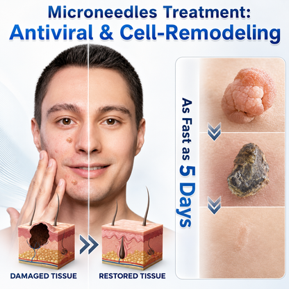 𝑵𝐞𝒌𝐢𝐬𝐬® 🌎 𝐁𝐨𝐭𝐚𝐧𝐢𝐜𝐚𝐥 𝐌𝐢𝐜𝐫𝐨𝐧𝐞𝐞𝐝𝐥𝐞 𝐇𝐲𝐝𝐫𝐨𝐜𝐨𝐥𝐥𝐨𝐢𝐝 𝐏𝐚𝐭𝐜𝐡 (𝐅𝐨𝐫 𝐒𝐤𝐢𝐧 𝐓𝐚𝐠𝐬, 𝐒𝐦𝐚𝐥𝐥 𝐒𝐤𝐢𝐧 𝐆𝐫𝐨𝐰𝐭𝐡𝐬, 𝐖𝐚𝐫𝐭𝐬, 𝐌𝐨𝐥𝐞𝐬, 𝐀𝐠𝐞 𝐒𝐩𝐨𝐭𝐬 & 𝐏𝐢𝐠𝐦𝐞𝐧𝐭𝐚𝐭𝐢𝐨𝐧 𝐂𝐨𝐧𝐜𝐞𝐫𝐧𝐬)